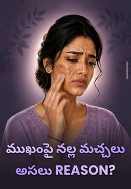 ముఖంపై నల్ల మచ్చలు -అసలు Reason?