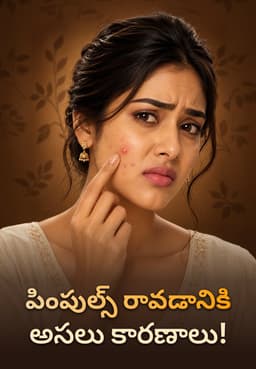 పింపుల్స్ రావడానికి అసలు కారణాలు!