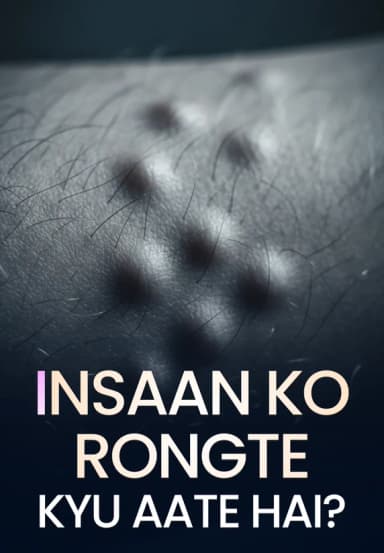 Insaan Ko Rongte Kyu Aate Hai?