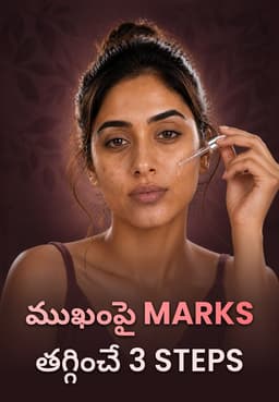 ముఖంపై Marks తగ్గించే 3 Steps